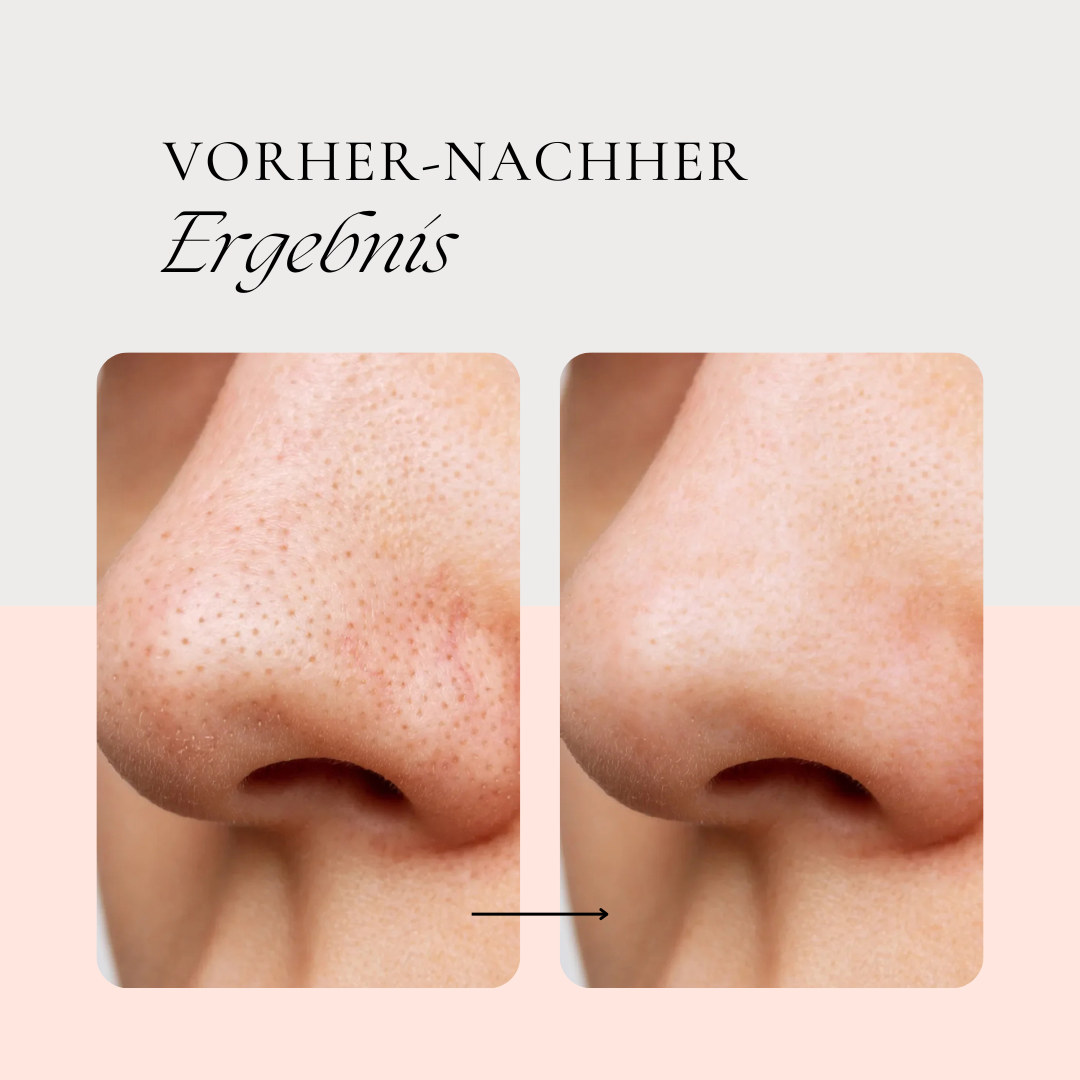 esilee™ - Porefinity