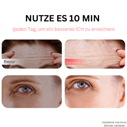 4-in-1 Gesicht Rotlicht Therapie