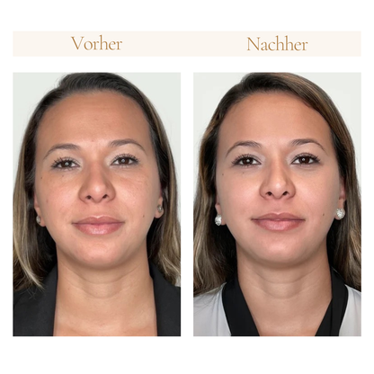 esilee™ - Purify Pro