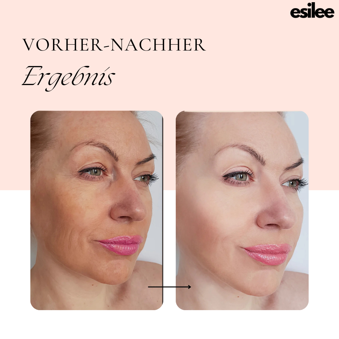 esilee™ LumiWave Pro