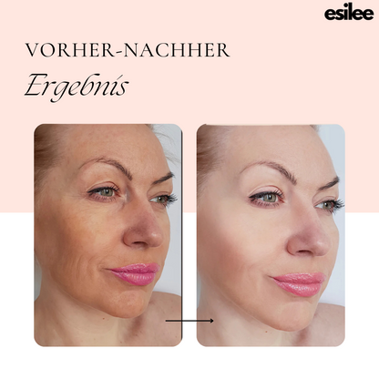 esilee™ LumiWave Pro